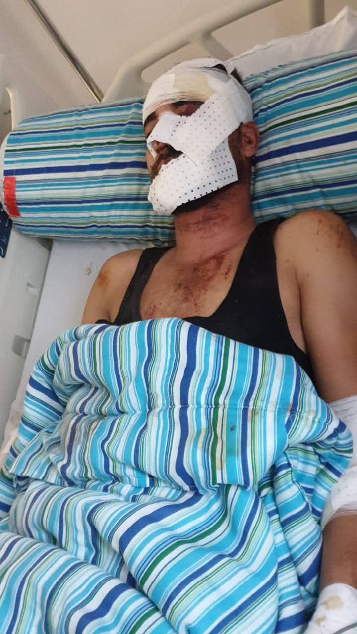 بني بوعياش: حادثة مأساوية تكشف عن واقع البنية التحتية و