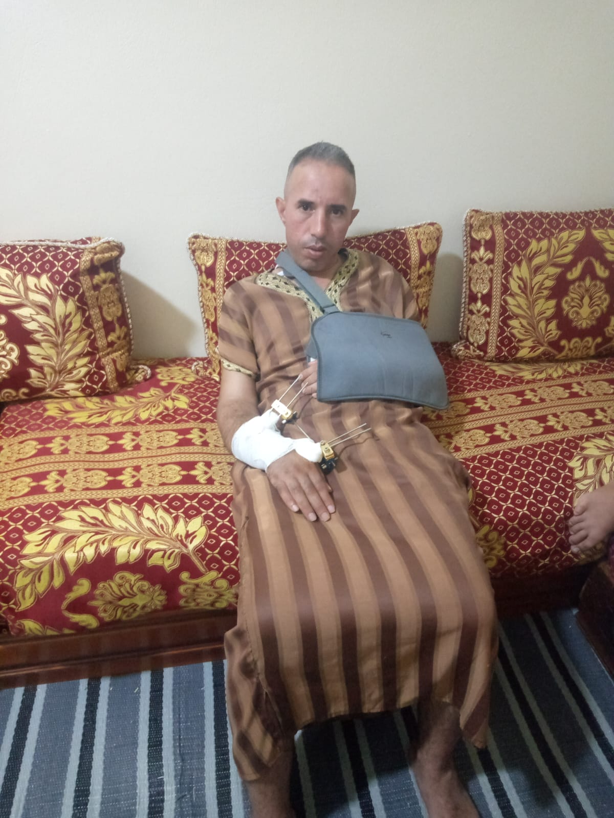 طنجة : حادث ورش يغيّر حياة شاب بطنجة: عبد الإله القدوري بين الأزمة الصحية والمالية
